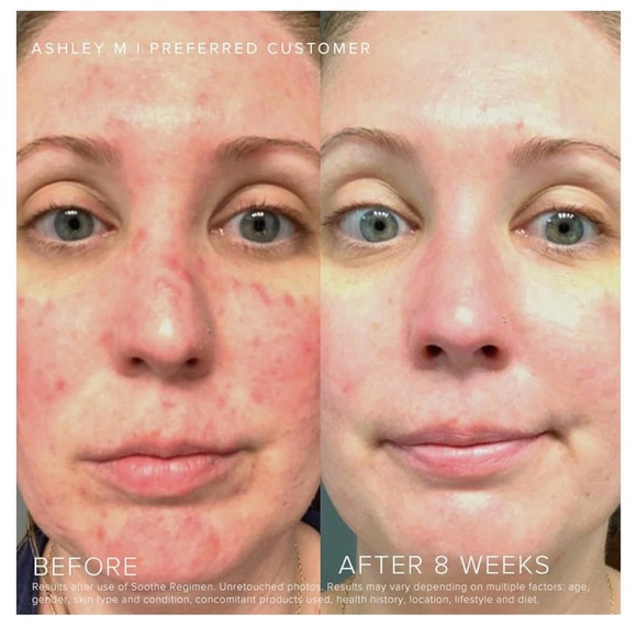 Rodan FieldsSoothe Daily Mineral Sunscreen/new in box / exp 12/2026 - Picture 4 of 10